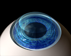 Cells removed